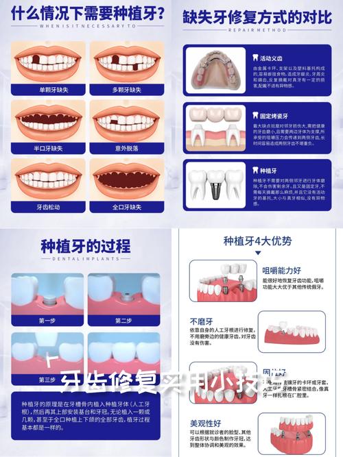 牙周治疗