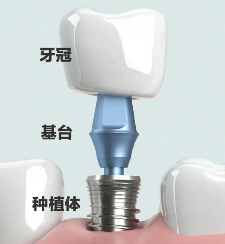 美学修复