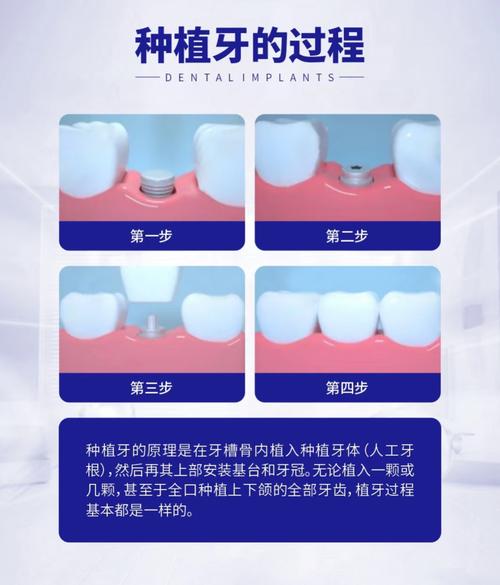 第一次去会做什么