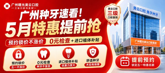 广州种牙速看！曙光美云口腔5月特惠提前抢，预约锁价不涨价，0元检查+进口植体补贴