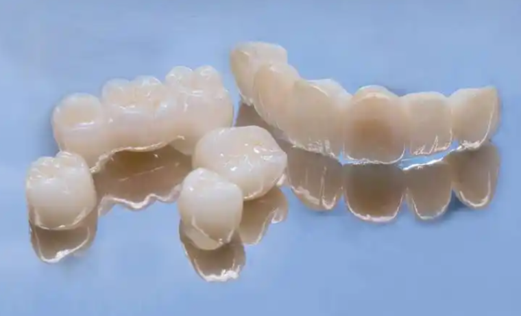 五、關(guān)于口腔醫(yī)院假牙價(jià)格表，你可能還想知道這些