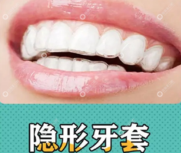 2026隐形矫正牙套价目表:隐适美/时代天使/正雅收费上贝色查